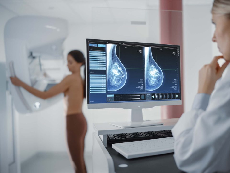 Breast Cancer Computer Screen in Hospital Radiology Room: Beautiful Multiethnic Adult Woman Standing Topless Undergoing Mammography Screening Procedure. Screen Showing the Mammogram Scans of Dense Breast Tissues.