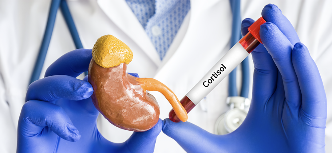 Understanding Cushing Syndrome and Its Silent Impact