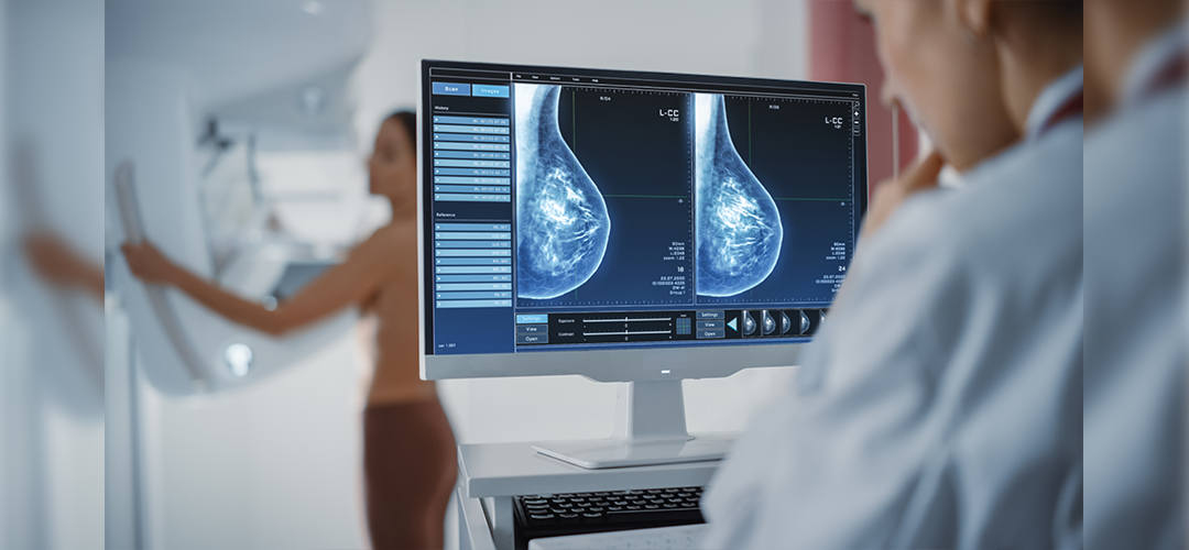 Breast Cancer Symptoms