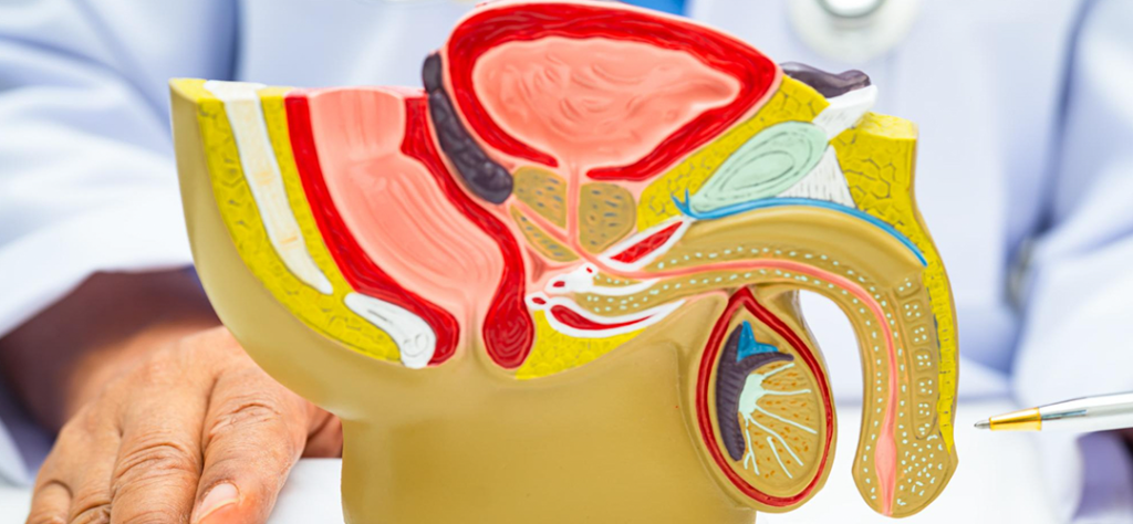 prostate cancer symptoms