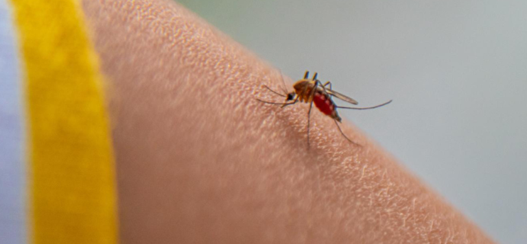 malaria symptoms
