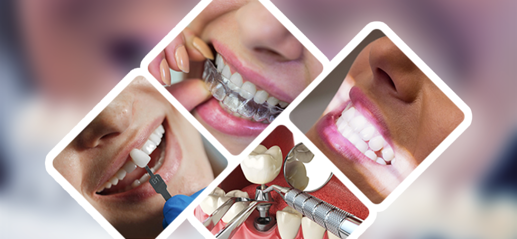 Cosmetic Dentistry Treatments