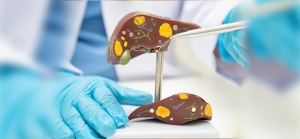 Hepatitis symptoms