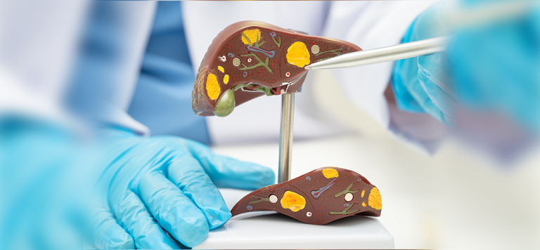 Hepatitis symptoms